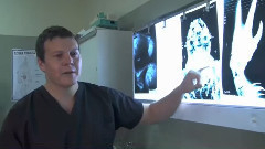 电影<第九区>花絮之Doctor Exoskeleton