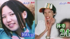 日本娱乐 - 神经性无食欲症(进食障碍)可怕的一面