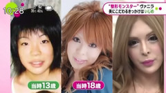 日本娱乐 - 日本整容魔女,理想是法国人偶